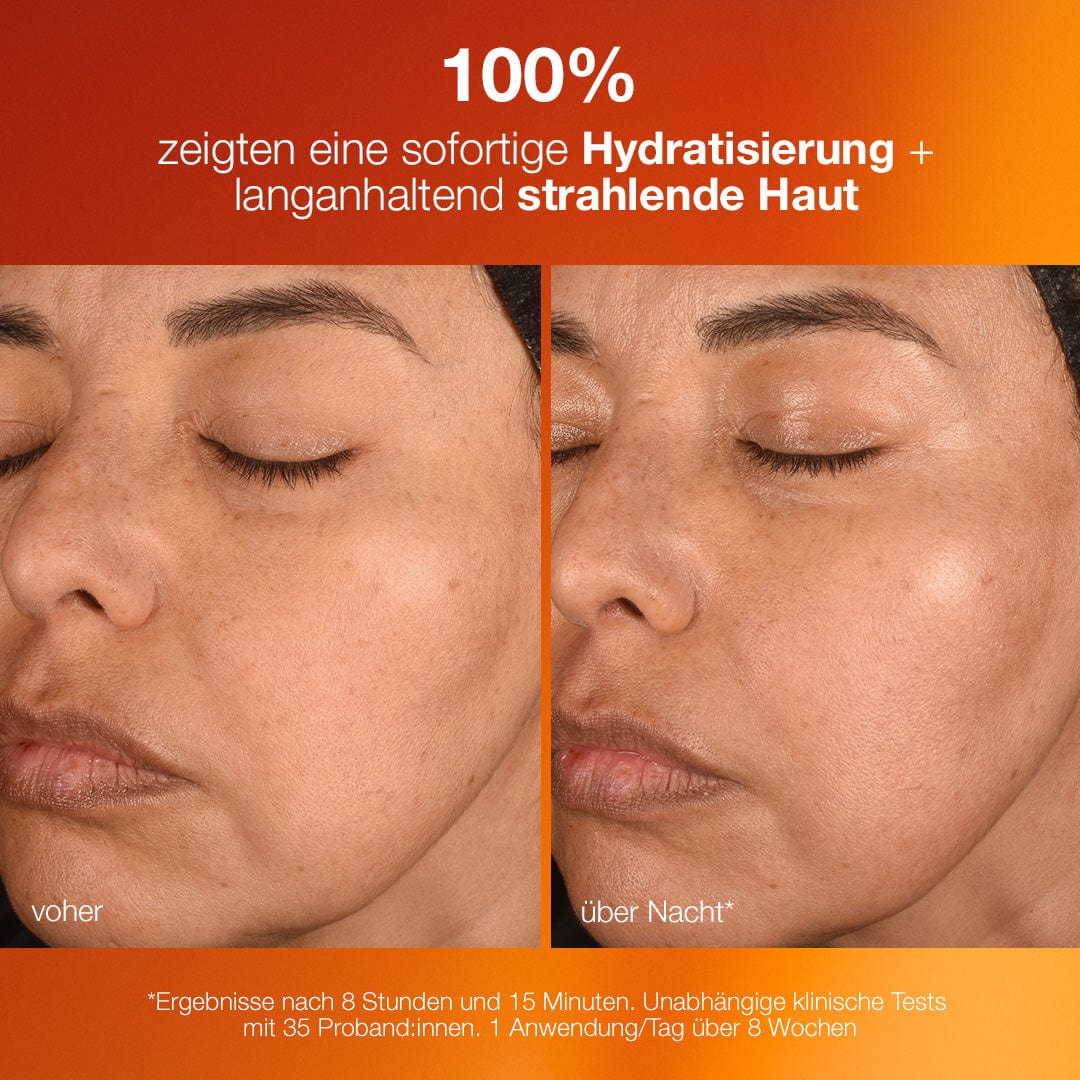 Nebeneinanderstellung des Gesichts einer Person vor und nach der Verwendung eines Hautpflegeprodukts. Die Haut erscheint auf dem „Nachher“-Bild dank des Presell Biolumin-C Night Restore | Vitamin-C Serum für die Nacht hydratisierter und strahlender. Der Text auf Deutsch hebt die Wirksamkeit des Produkts hervor.