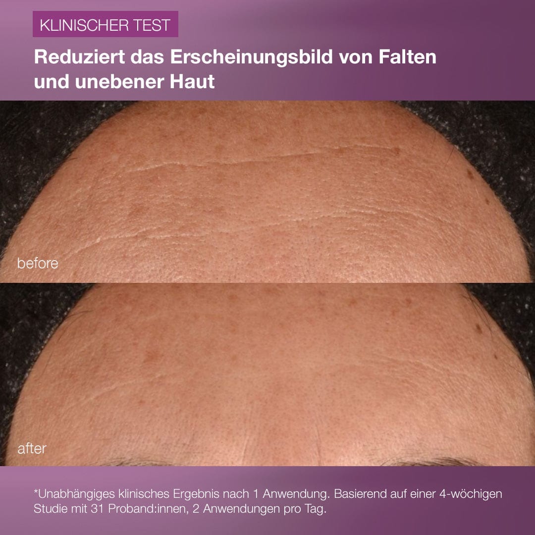 Ein Nebeneinandervergleich der Stirnhaut vor und nach der Anwendung der MultiVitamin Power Recovery Cream zeigt weniger Fältchen und eine glattere Hautstruktur. Der deutsche Text zeigt anhand eindrucksvoller klinischer Testergebnisse, wie Antioxidantien helfen, Hautalterung vorzubeugen.